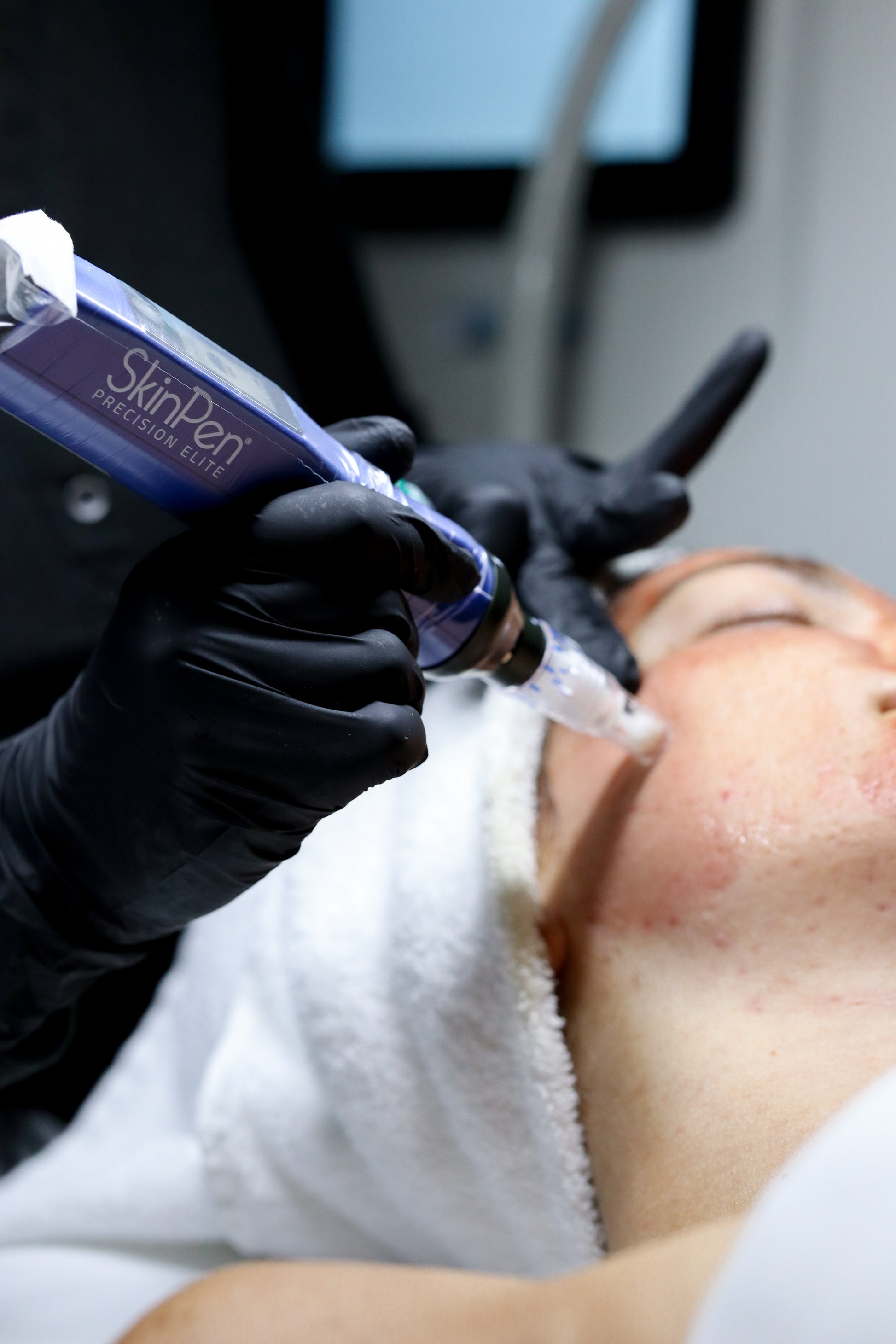 Skin Pen Micro Needling Pkg of 6